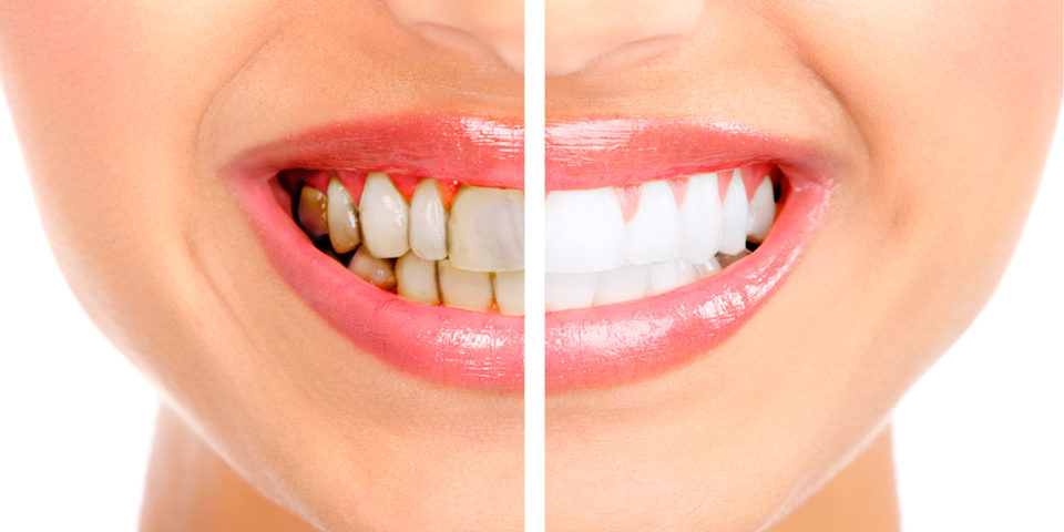 Rehabilitación Oral - Servicios Odontológicos